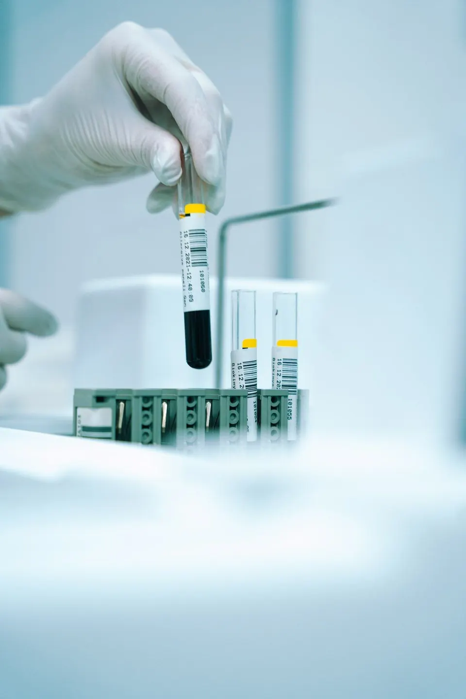 Blood sample tubes being handled in a laboratory